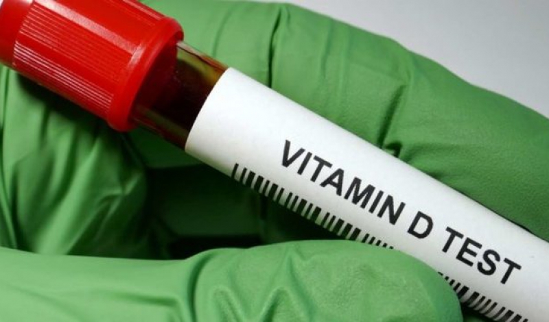 کمبود ویتامین D به صورت معضل جهانی در تمام کشورها مطرح است