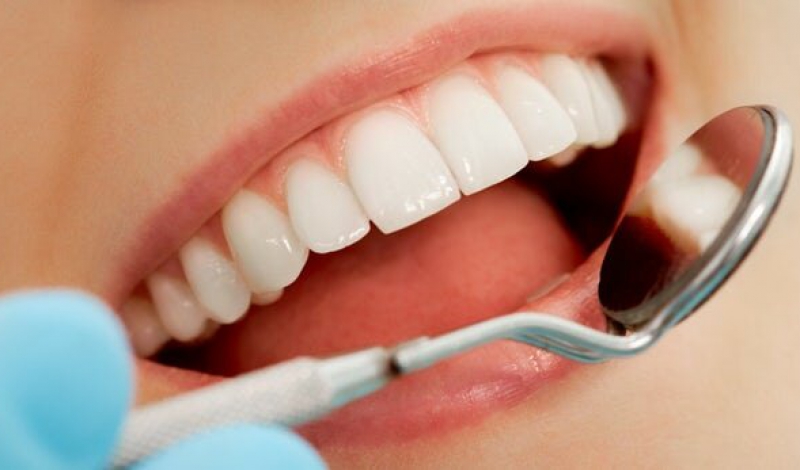سیستم ایمنی بدن می تواند باعث پوسیدگی دندان شود