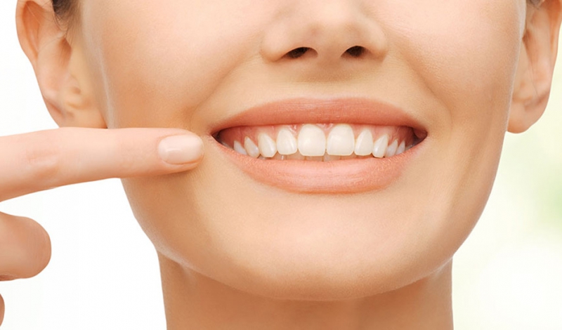 ۵ درمان خانگی برای پوسیدگی دندان 