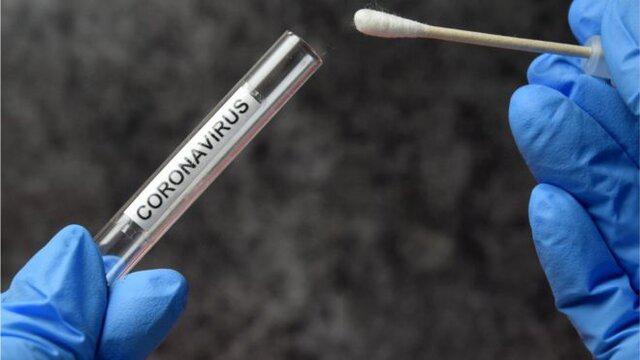 تست PCR قابل اعتمادتر است یا نتیجه سی تی اسکن؟