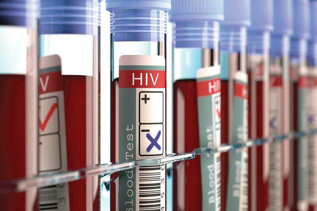 آزمایش موفق انسانی واکسن جدید ایدز