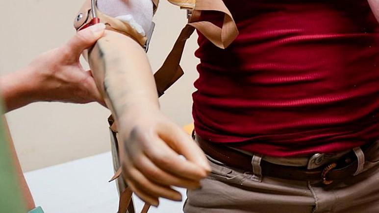 نتیجه تلاش یک مرد برای دریافت واکسن کووید روی بازوی مصنوعی