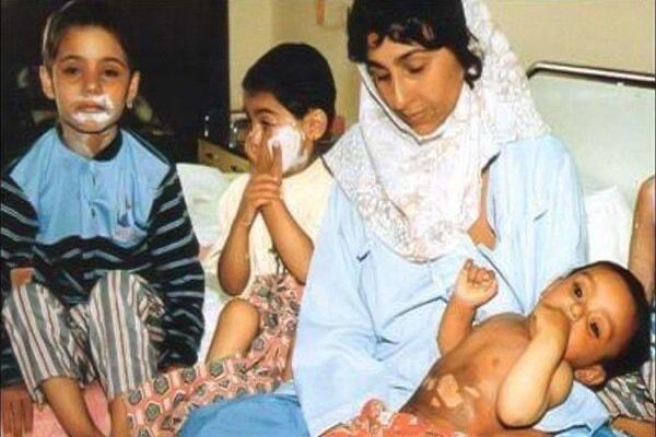 یادی از قربانیان فاجعه بمباران شیمیایی سردشت توسط صدام به روایت تصاویر دردناک