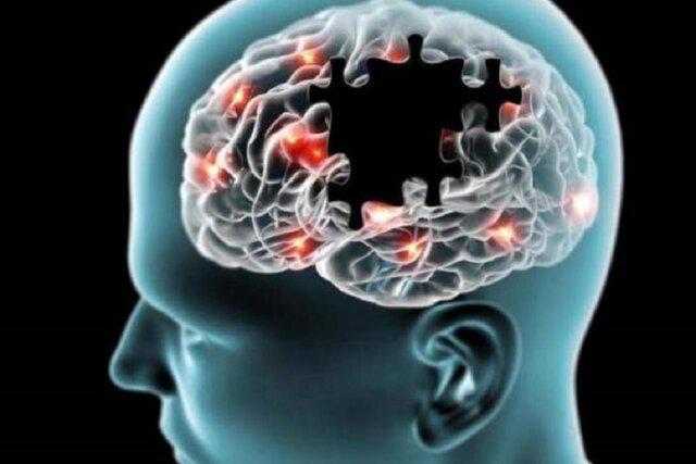  علائم هشدار دهنده بیماری آلزایمر
