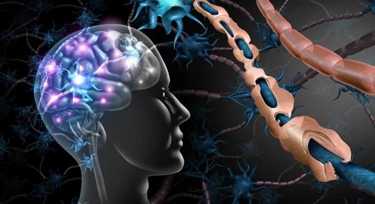 بیماری ام اس چگونه به وجود می آید؟