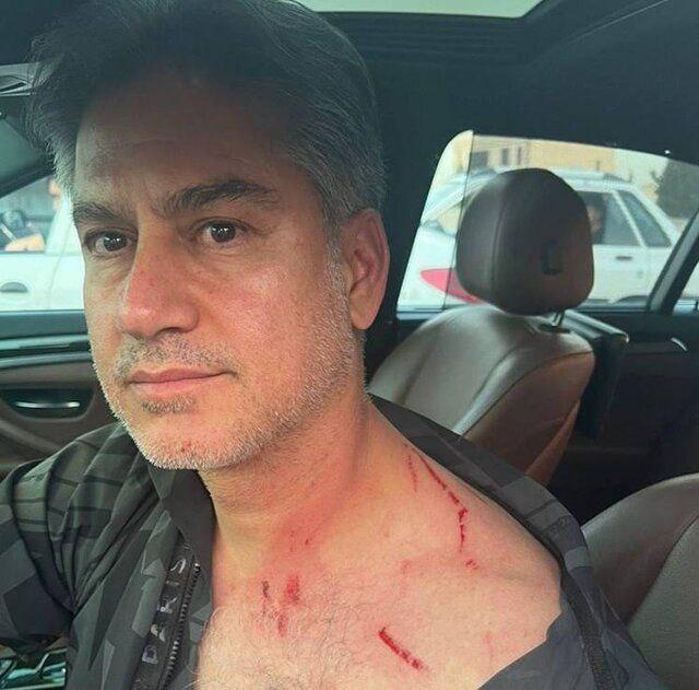 زورگیری از مربی تیم ملی فوتبال در روز روشن
