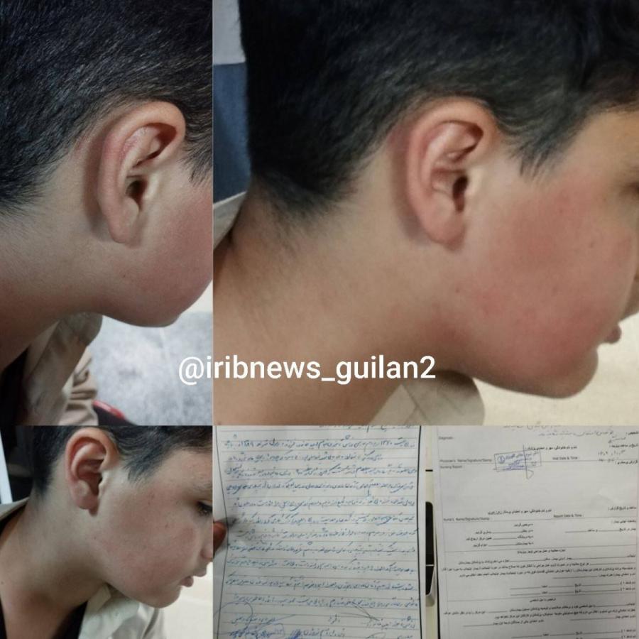 لغو ابلاغ معلم خاطی در پی تنبیه بدنی دانش آموز لاهیجانی