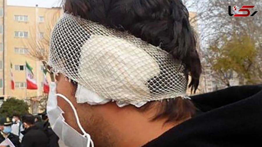 معلم سابق گوشِ پسر جوان را با دندان کَند