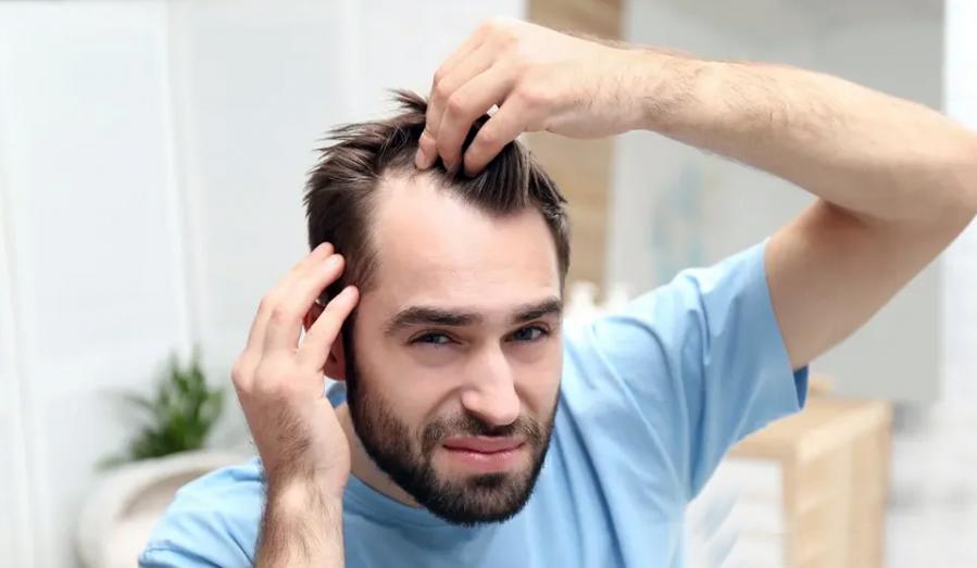 چه زمانی ریزش مو غیرطبیعی است؟