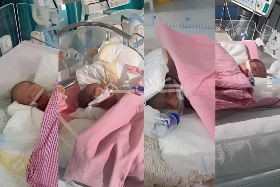 زن ۲۷ ساله در اولین زایمان، صاحب چهار قلو شد