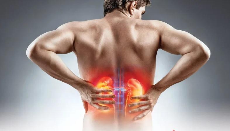 چگونه خطر سنگ کلیه را کاهش دهیم؟