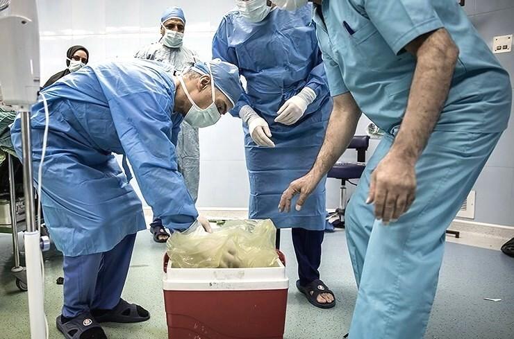 اهدای عضو زن و مرد رشتی در یک روز، جان ۶ بیمار را نجات داد