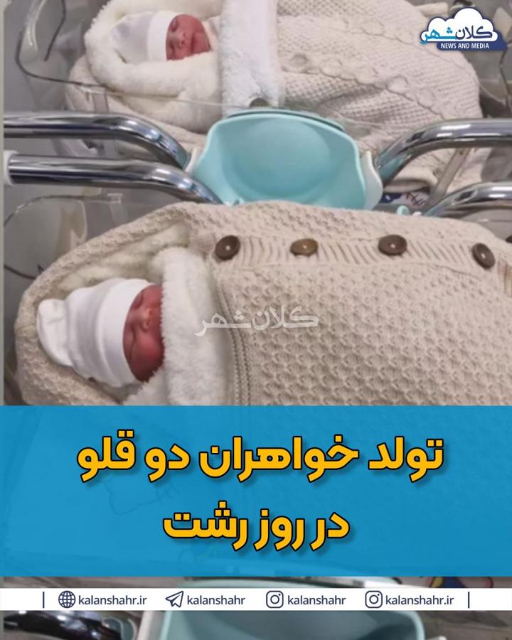 تولد خواهران دو قلو در «روزِ رشت»/عکس