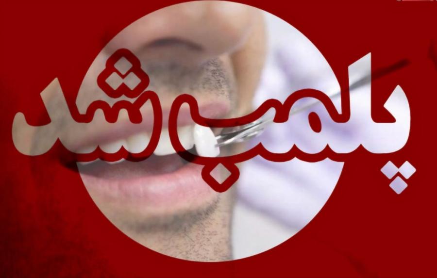 پلمب مطب دندانپزشک قلابی در بلوار افتخاری رشت هنگام کامپوزیت یک مراجعه کننده