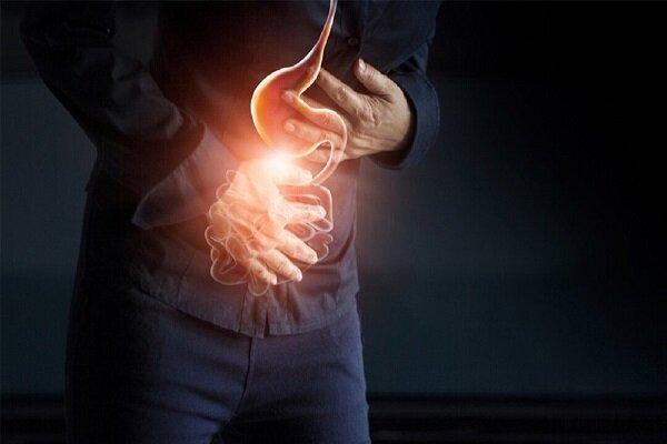 هر آنچه باید درباره رفلاکس معده بدانید