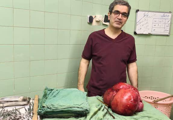 خارج کردن توده ۱۰ کیلوگرمی از شکم بیمار  ۴۸ ساله