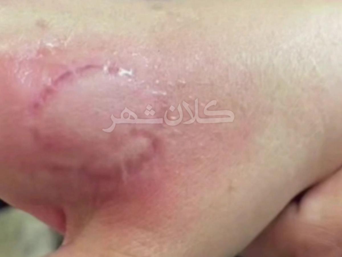 از «گاز» گرفتن دست معلم تا تنبیه بدنی دانش آموزان؛ بچه ها «بی تربیت» شده اند یا معلمان کم حوصله؟