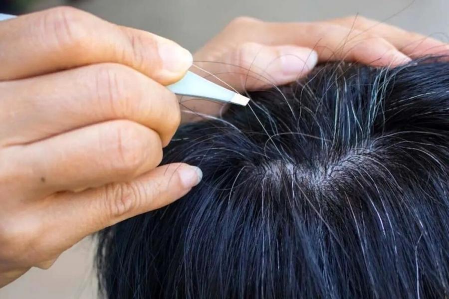 آیا می‌توان جلوی سفید شدن موها را گرفت؟/ دلیل سفیدی مو در نواحی شقیقه‌ها