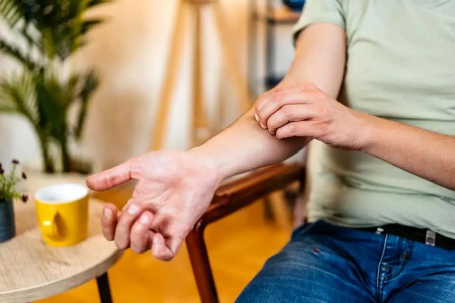 چرا نباید جای نیش حشرات را بخارانیم؟