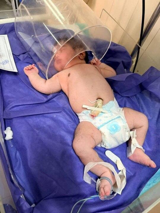 مادر ۲۷ ساله کرمانشاهی در هفتمین بارداری، نوزاد ۵ کیلو و ۶۵۰ گرمی به دنیا آورد