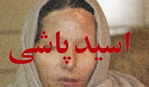 طرح تشدید مجازات اسیدپاشی در شورای نگهبان تایید شد
