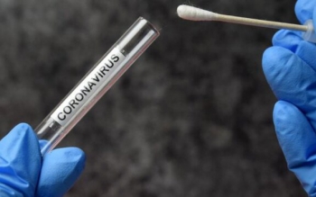 تست PCR قابل اعتمادتر است یا نتیجه سی تی اسکن؟