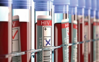 آخرین وضعیت HIV در ایران / نیمی از مبتلایان در سنین ۲۵ تا ۳۹ سال