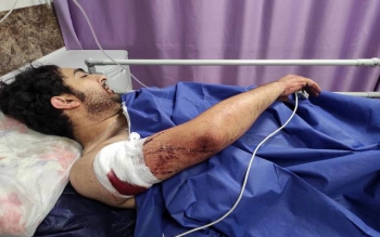 خفت گیری از یک عکاس خبری به قصد اخاذی با ۲۱ ضربه چاقو