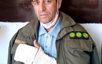  شکارچیان انگشتان و گردن این محیط بان را در صف نانوایی بریدند
