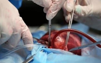 سالانه سه هزار نفر به دلیل نبود عضو پیوندی فوت می کنند