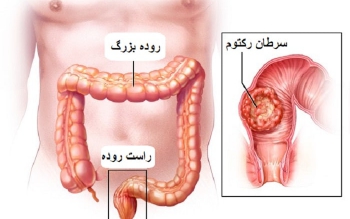 درمان همه بیماران مبتلا به سرطان با یک دارو