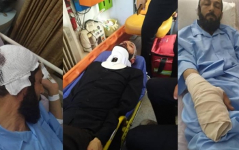 یکی از امامان جماعت:با لوله آهنی به سر و صورت می کوبیدند
