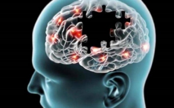  علائم هشدار دهنده بیماری آلزایمر