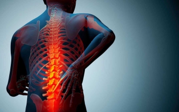 از هر ۳ زن و هر ۵ مرد در جهان یک نفر مبتلا به پوکی استخوان است