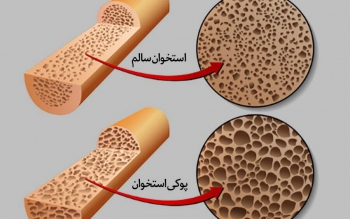 ویتامینی که بیماری خاموش را ضربه فنی می کند