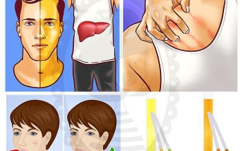  چگونه بفهمیم کبدمان خوب کار نمی کند؟ 