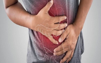 چند ملین طبیعی برای عملکرد روده
