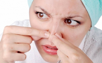 دستکاری جوش در این ناحیه از صورت خطر مرگ به همراه دارد