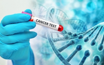 پوشش بیمه ۳ سرطان شایع در دستورکار/برقراری پوشش آزمایشات HPV