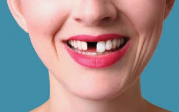 ابداع دارویی برای رشد مجدد دندان در انسان!