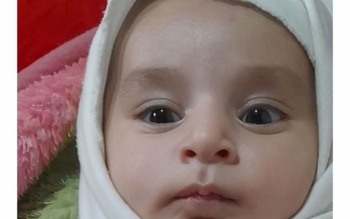 اعضای بدن دختر یک ساله بعد از مرگ مغزی به دو بیمار زندگی دوباره بخشید
