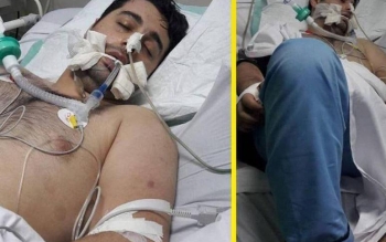 تصویر منتشر شده از جواد روحی در بیمارستان قدیمی است/متهم سابقه تشنج و بستری داشته