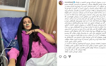 حمله سارق موبایل با قمه به بازیگر زن/ عکس