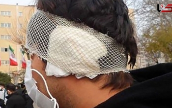 معلم سابق گوشِ پسر جوان را با دندان کَند