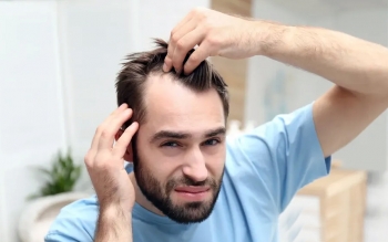چه زمانی ریزش مو غیرطبیعی است؟