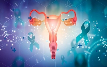 افزایش ۴ برابری احتمال سرطان تخمدان در زنان مبتلا به اندومتریوز