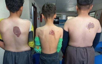 تشکیل پرونده قضایی برای خیاطی که شاگردانش را با اتو داغ کرد