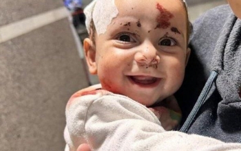 عکس پربازدید از لبخند شیرین کودک لبنانی که در حمله اسرائیل مجروح شد