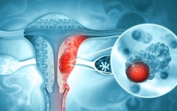 چرا  ۱۹۴ کشور تصمیم گرفتند سرطان دهانه رحم را حذف کنند؟