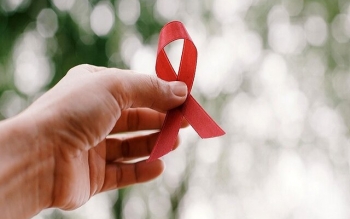 ۷۳ درصد مبتلایان HIV در گروه سنی ۲۰ تا ۴۵ سال